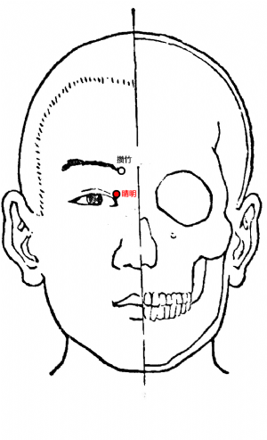 睛明穴的位置.png